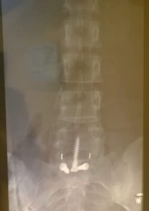 BackScrews's LeafedOut Profile
